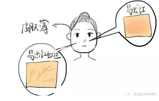 10大抗敏感护肤品，敏感肌肤护肤品排行榜