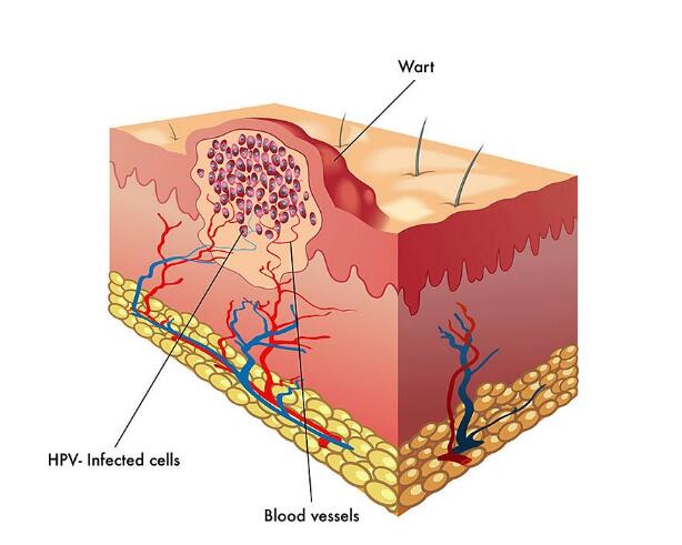 肌肤和皮肤的区别字义