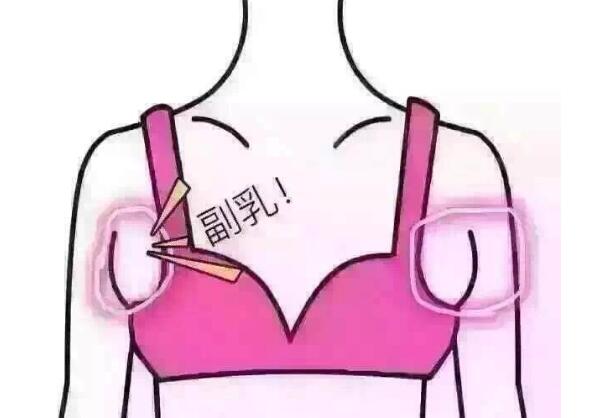怎么消除副乳？简单动作让你和副乳说拜拜