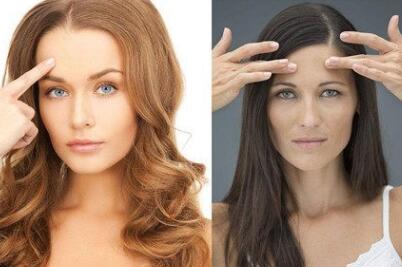 额头长皱纹是什么原因