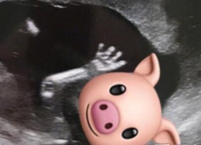 胡杏儿宣布怀二胎 迎来猪宝宝