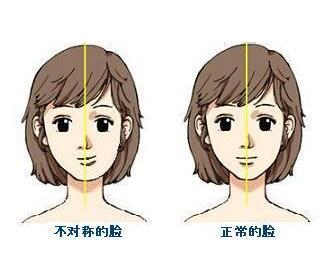 脸不对称 找准原因解决问题