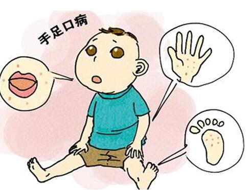 手足口病的传播途径有哪些 这种是传染性的疾病