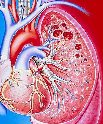 一天两个时段的养肺方法