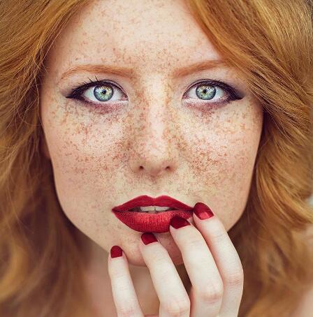不同肤质的祛斑方法以及祛斑小窍门
