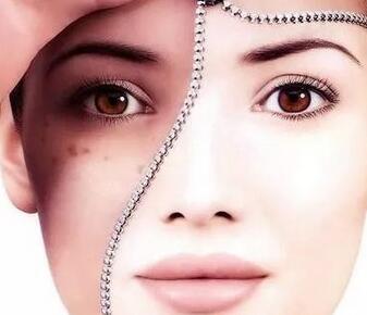 脸上黑色痘印如何去除 还是要给痘印消炎