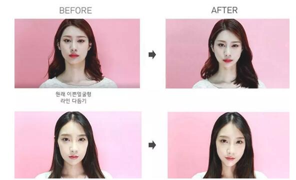 韩国瘦脸贴有用吗 韩国瘦脸贴很火