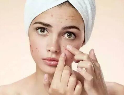 维生素e护肤怎么用 可以抗氧化美白养颜