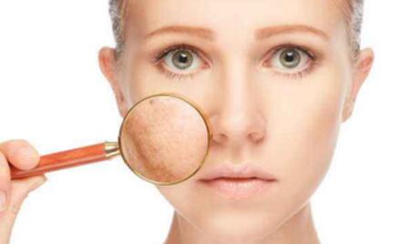 激光祛斑的危害 会给我们带来灼伤