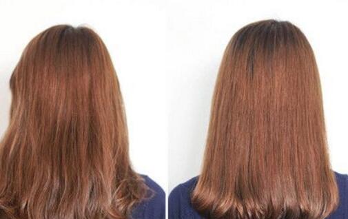 不吃饭会掉头发吗 头发大量脱落的原因