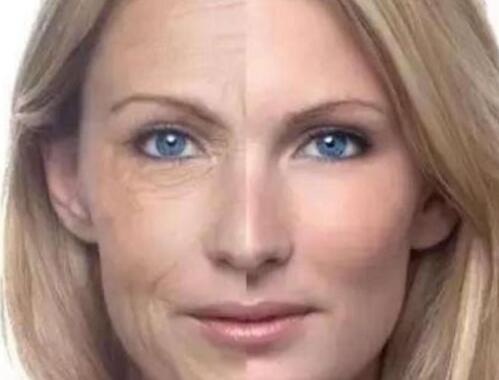 油性皮肤能改变吗 皮肤油是会影响颜值的