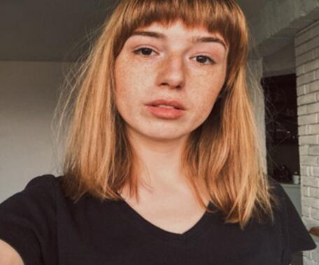 女性脸上有雀斑 如何预防雀斑产生