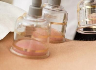 拔罐时间越长越好 牢记拔罐五大误区