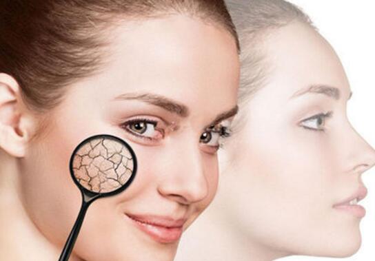 女性脸部肌肤长红血丝 可能就是外界的因素