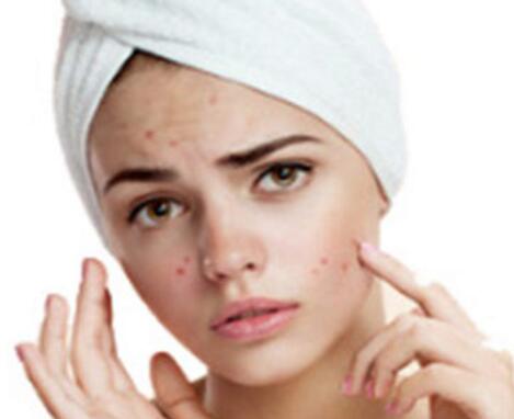 防晒护理的关键之处 防晒是非常重要的内容