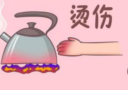 处理烫伤最专业的方法 怎么判断自己的伤势呢