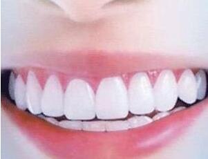 牙齿美白贴真的有效吗 对健康有影响吗