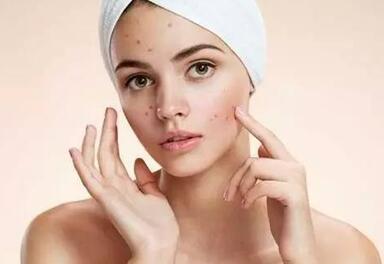 粉刺针如何正确使用 一起来看看吧