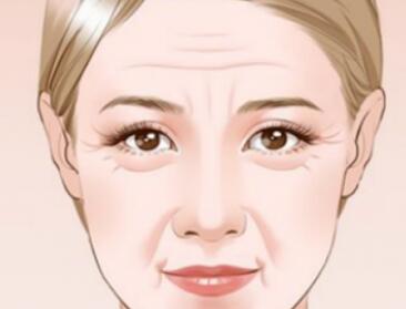 预防法令纹的日常工作以及按摩手法