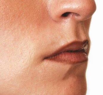 导致流鼻血的原因有哪些