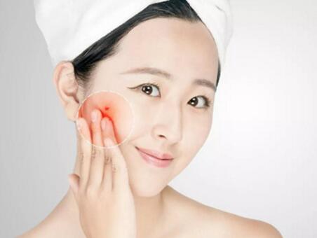 脸上红血丝不能忽略 拒绝肌肤敏感