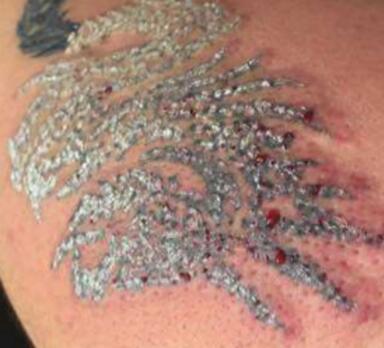 怎样清洗纹身 洗纹身痛不痛啊 洗纹身的正确方法