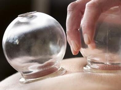 拔火罐后 皮肤上会出现一些深色的印记是否正常