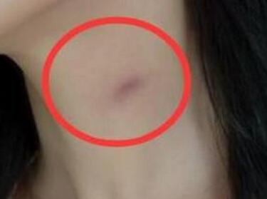 种草莓是什么意思 种草莓的技巧该怎么吸