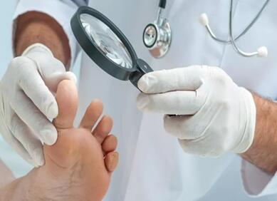 脚气是什么症状 治脚气最有效的方法你知道吗