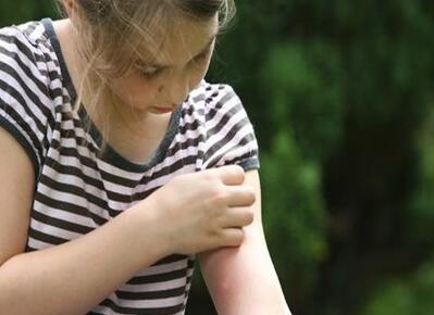 蚊子为什么还要偏偏叮我 那么到底是什么让蚊子偏偏爱上你