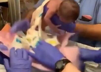 新生儿就被医生意外手滑摔到了产台上