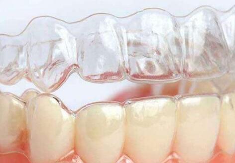 门牙有缝应该怎么办呢 门牙断了又应该怎么办呢