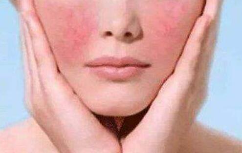 天生红血丝如何修复 造成红血丝的原因