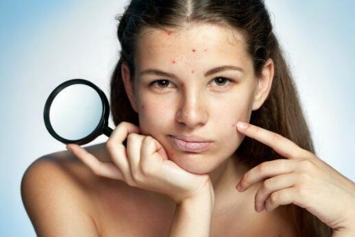 额头长痘痘严重影响心情！怎么去除痘痘？