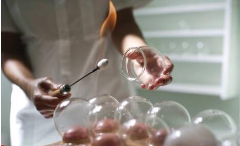 夏天拔罐可以祛湿？请注意一种“湿人”不适合拔罐！