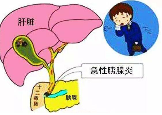 天天吃外卖27岁姑娘血浆成“猪油色”还住进了ICU 真凶是什么？