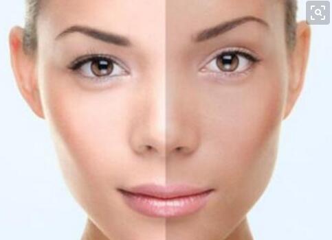 女性皮肤为什么会发黄 原来这才是原因！