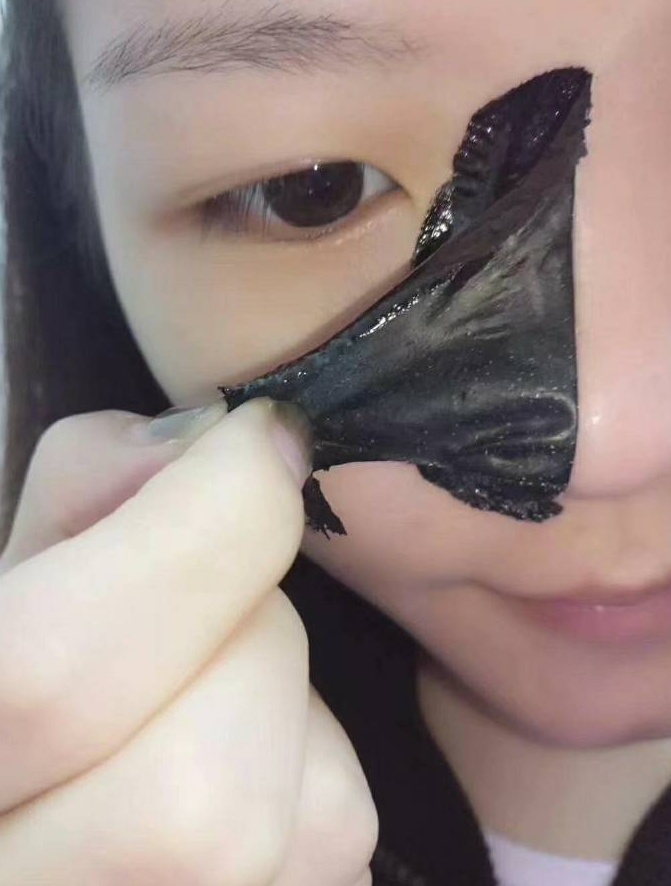 不想再要黑头了 黑头可以一次性根除不再长吗