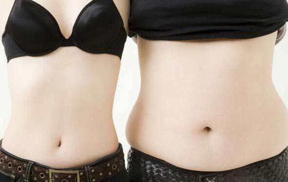 胖竟是“传染病” 快速减肥的小习惯你一定要知道