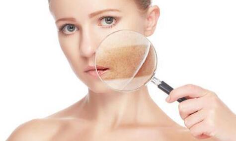 皮肤过敏吃什么水果 皮肤过敏不能吃什么