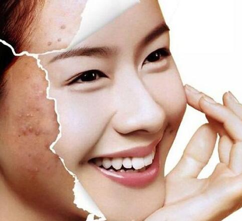美白针效果怎么样 美白针到底安不安全