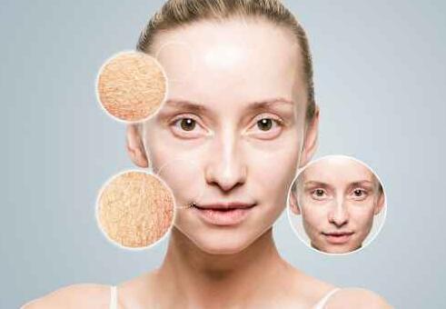 皮肤干燥起皱纹是皮肤老化的表现 皮肤干燥起皱纹怎么办