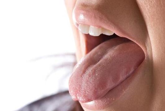 舌苔发黄预示着疾病正在潜伏 六种不同的症状看看你是哪一种？