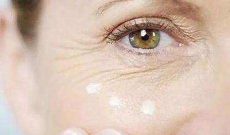 怎么快速去除眼角皱纹 去眼角纹要多少钱