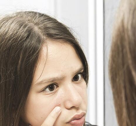 巧用生姜快速去疤痕 去疤痕最好的方法