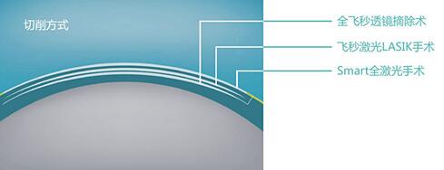 近视激光手术会不会疼 激光近视手术的后遗症有哪些？