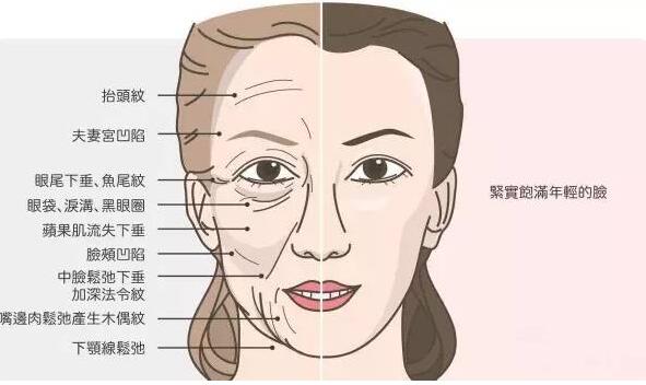 法令纹深的主要原因 消除法令纹的三种方法教你恢复年轻