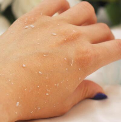 去死皮的正确方法 怎样去除脸部和嘴唇死皮