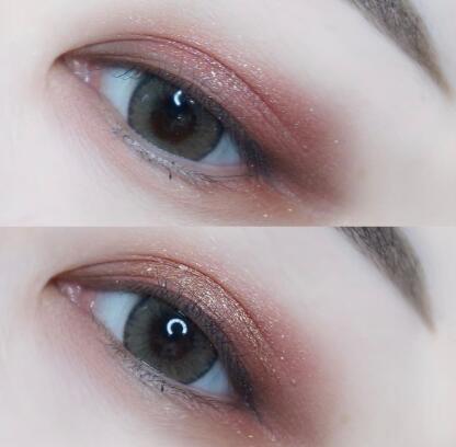 戴美瞳发炎了怎么办 怎样戴美瞳不容易发炎