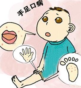 小孩手足口病症状 手足口病怎样治疗 小儿手足口病如何护理